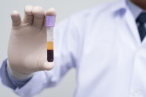 Doctor holding vial of separated blood