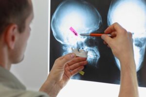 Doctor looking at X-ray of patient’s jaw