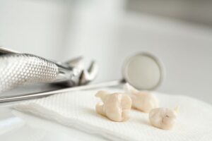 Three extracted teeth on table next to dental instruments